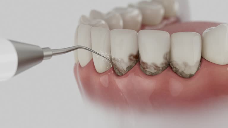 Trusted Tooth Extraction service in Bear Creek Ranch, TX - Dentist Open Now